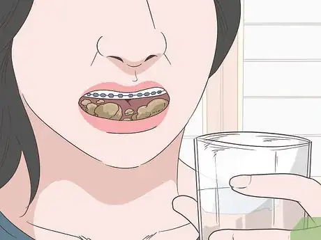 Image intitulée Eat Food With New or Tightened Braces Step 6