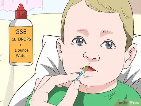 Image intitulée Get Rid of Thrush in Infants Step 4