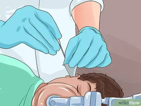 Image intitulée Know if You Have Otitis Media Step 22