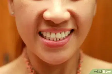 Image intitulée Whiten Your Teeth Without Spending a Lot of Money Step 10