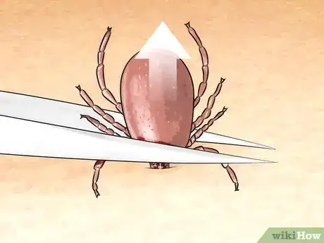 Image intitulée Get Rid of Bug Bites Step 14