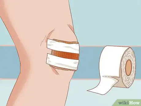 Image intitulée Apply Different Types of Bandages Step 20