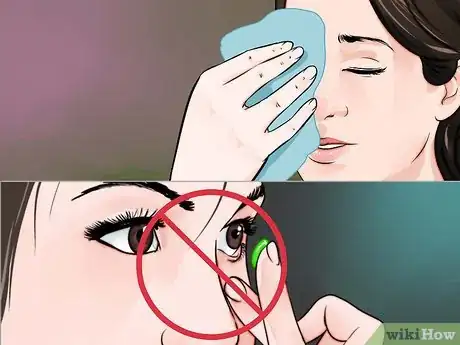 Image intitulée Treat Eye Infection Naturally Step 12