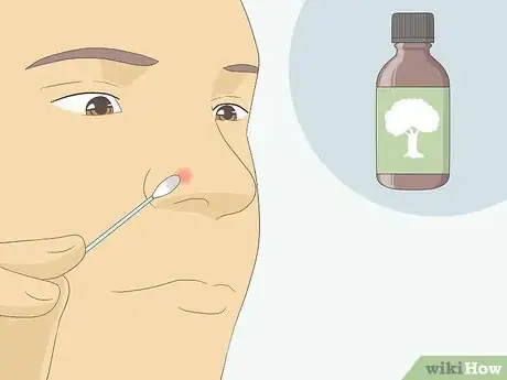 Image intitulée Get Rid of Acne Redness Fast Step 8