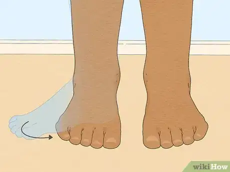 Image intitulée Fix Out Toeing in Adults Step 4