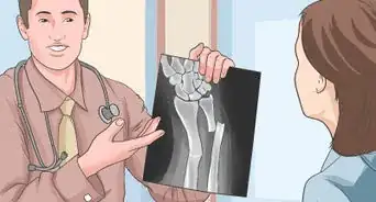 savoir si un os est fracturé sans passer de radiographie