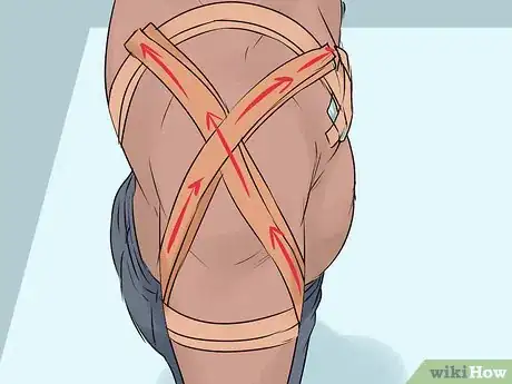 Image intitulée Strap a Dislocated Shoulder Step 7