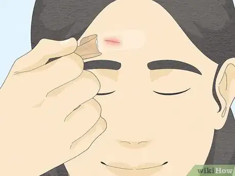 Image intitulée Remove a Band Aid Step 19