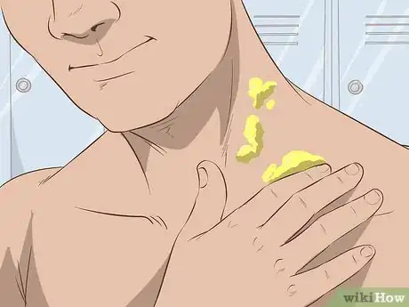 Image intitulée Get Rid of Neck Acne Step 15