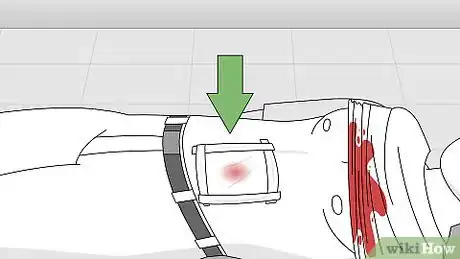 Image intitulée Attend to a Stab Wound Step 11