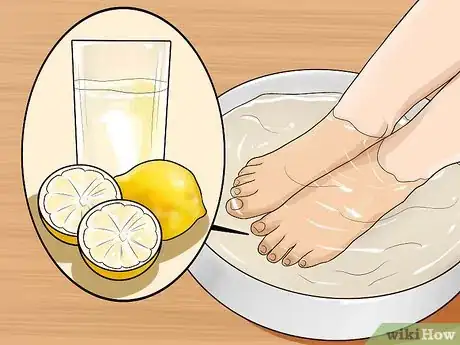 Image intitulée Get Rid of Yellow Toenails Step 13