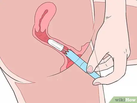 Image intitulée Insert a Tampon for the First Time Step 9