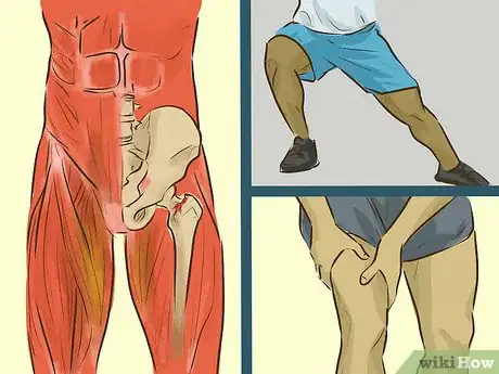 Image intitulée Treat a Groin Injury Step 7