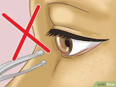 Image intitulée Get Dirt Out of Your Eye Step 11