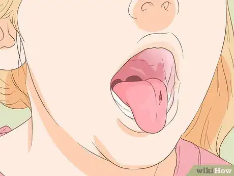Image intitulée Stop Tongue Bleeding Step 4