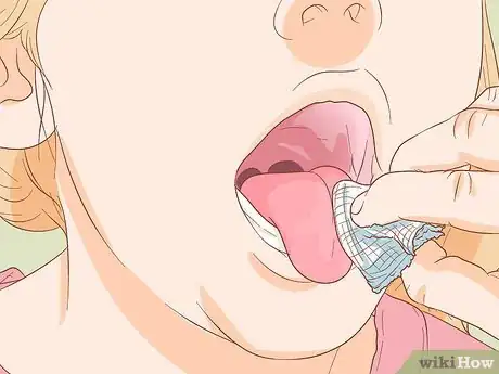 Image intitulée Stop Tongue Bleeding Step 5