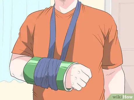 Image intitulée Make a Sling for Your Arm Step 10
