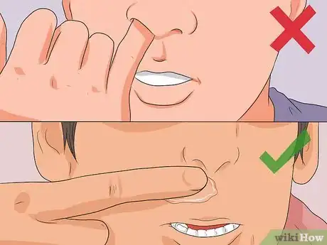 Image intitulée Stop a Nose Bleed Step 6