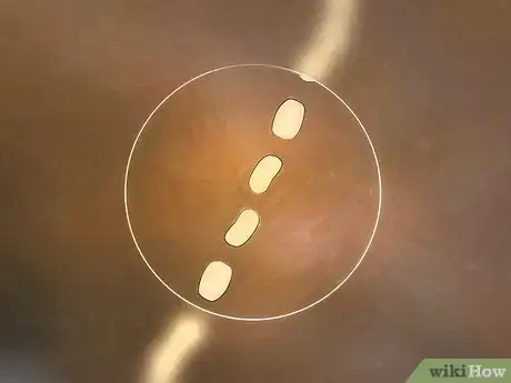 Image intitulée Get Rid of Tapeworms in Humans Step 3