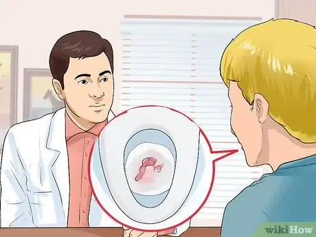 Image intitulée Stop Hemorrhoids from Itching Step 11