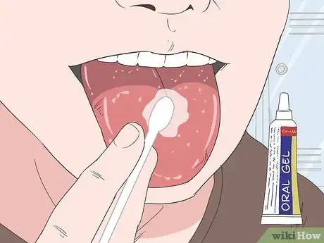 Image intitulée Heal Your Tongue After Eating Sour Candy Step 3