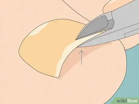 Image intitulée Remove a Dead Toenail Step 9