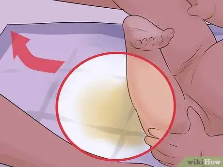 Image intitulée Help a Male Child Provide a Urine Sample Step 32