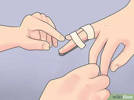 Image intitulée Splint a Finger Step 10