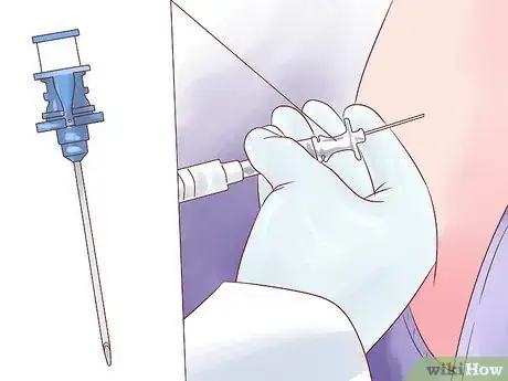 Image intitulée Cope with a Spinal Headache Step 13