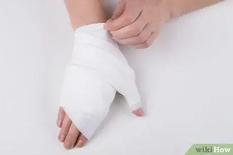 Image intitulée Wrap a Sprained Thumb Step 9