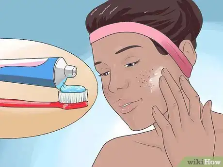 Image intitulée Heal a Pimple Step 5