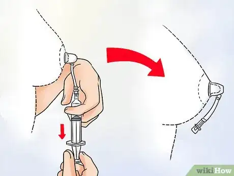 Image intitulée Get Rid of Inverted Nipples Step 10