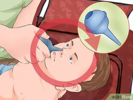 Image intitulée Clear a Baby's Stuffy Nose Step 15