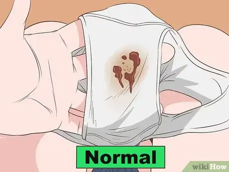 Image intitulée Tell if Vaginal Discharge Is Normal Step 5