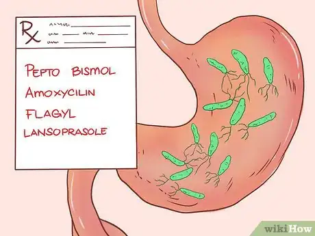 Image intitulée Know if You Have Gastritis Step 9