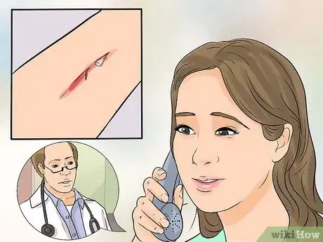 Image intitulée Determine if a Cut Needs Stitches Step 2