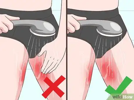 Image intitulée Prevent Chafing Between Your Legs Step 8