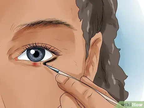 Image intitulée Get Rid of a Stye Step 11