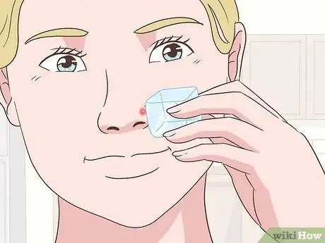 Image intitulée Get Rid of a Pimple Step 9