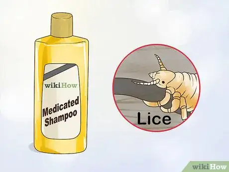 Image intitulée Get Rid of an Itchy Scalp Step 6