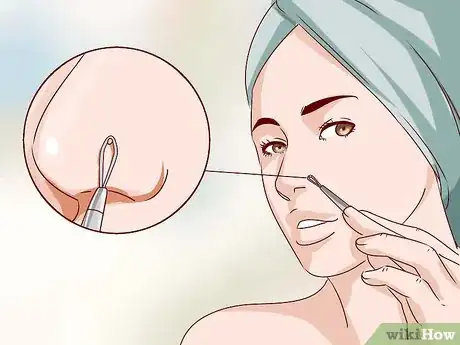 Image intitulée Buy a Blackhead Remover Step 8