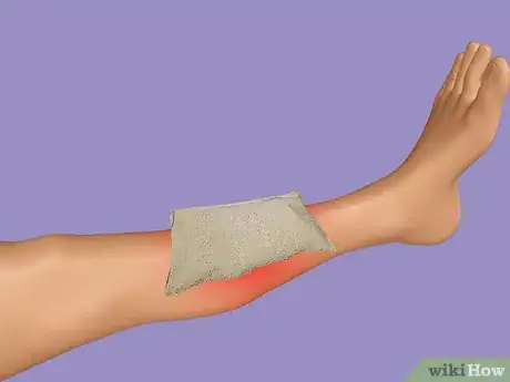 Image intitulée Treat Shin Splints Step 2