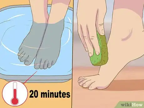 Image intitulée Remove Dead Skin from Feet Step 4