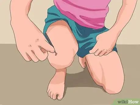 Image intitulée Heal a Skinned Knee Step 6