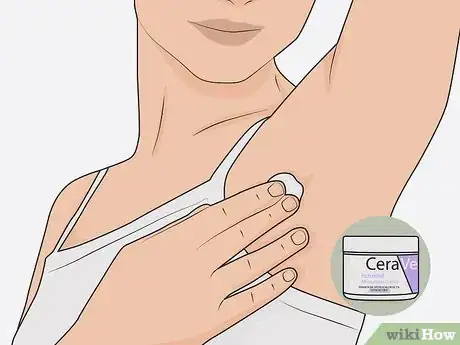 Image intitulée Heal Armpit Rash Step 5