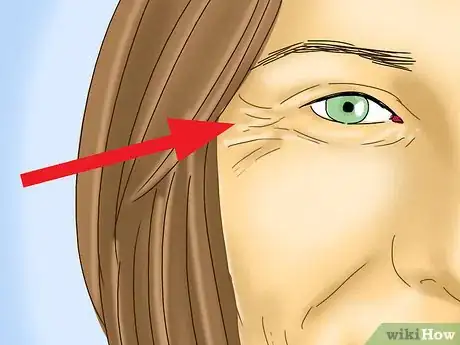 Image intitulée Take Out Contact Lenses Without Touching Your Eye Step 5