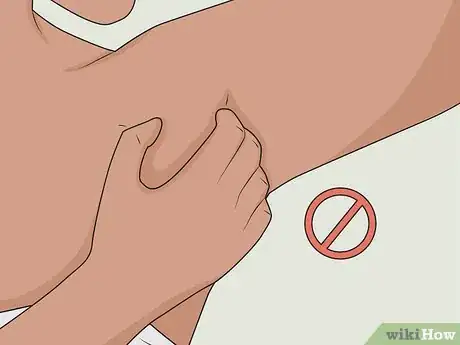 Image intitulée Heal Armpit Rash Step 6