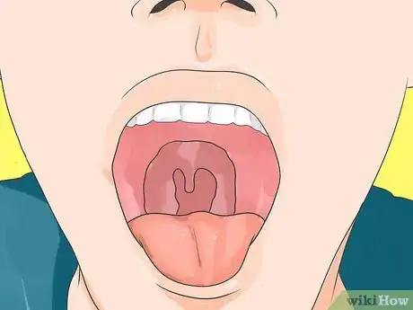 Image intitulée Clean Your Tongue Properly Step 1