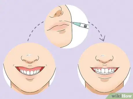 Image intitulée Smile Step 13