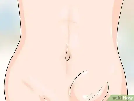 Image intitulée Know if You Have a Hernia Step 20